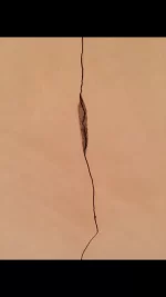 Skimming over cracks