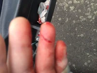 Ouch!!