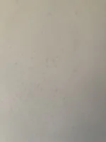 What are these spots